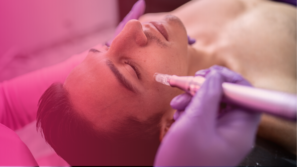 What does microneedling actually do?