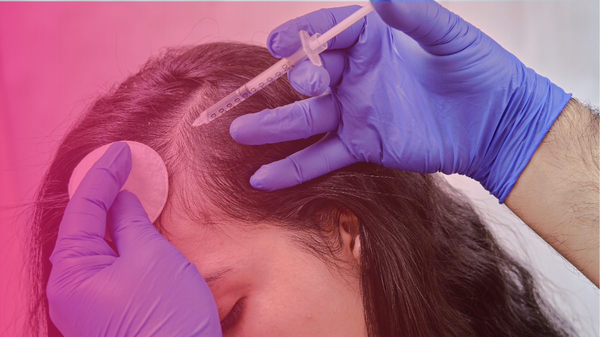 Does PRP actually work for hair loss?