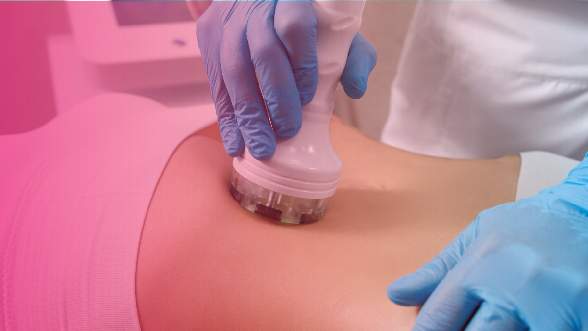 Does CoolSculpting actually work?