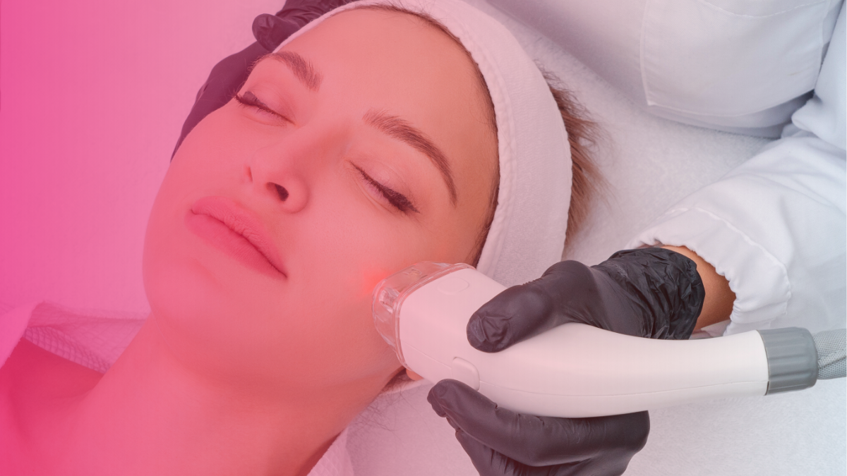 Morpheus8 vs Fraxel: Which Is Better for Skin Tightening?