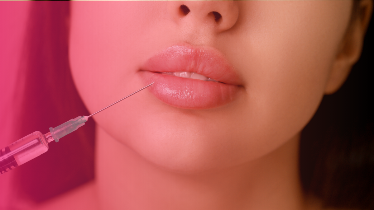 Lip Flip vs Lip Filler: Are They the Same Thing?
