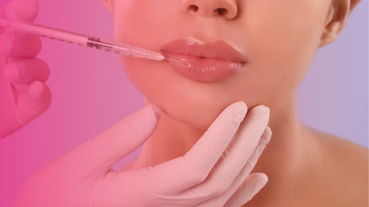10 Questions to Ask Before Booking Lip Filler