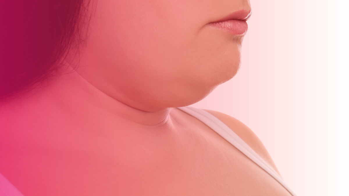 Kybella vs CoolSculpting for a Double Chin: Which Works Better?