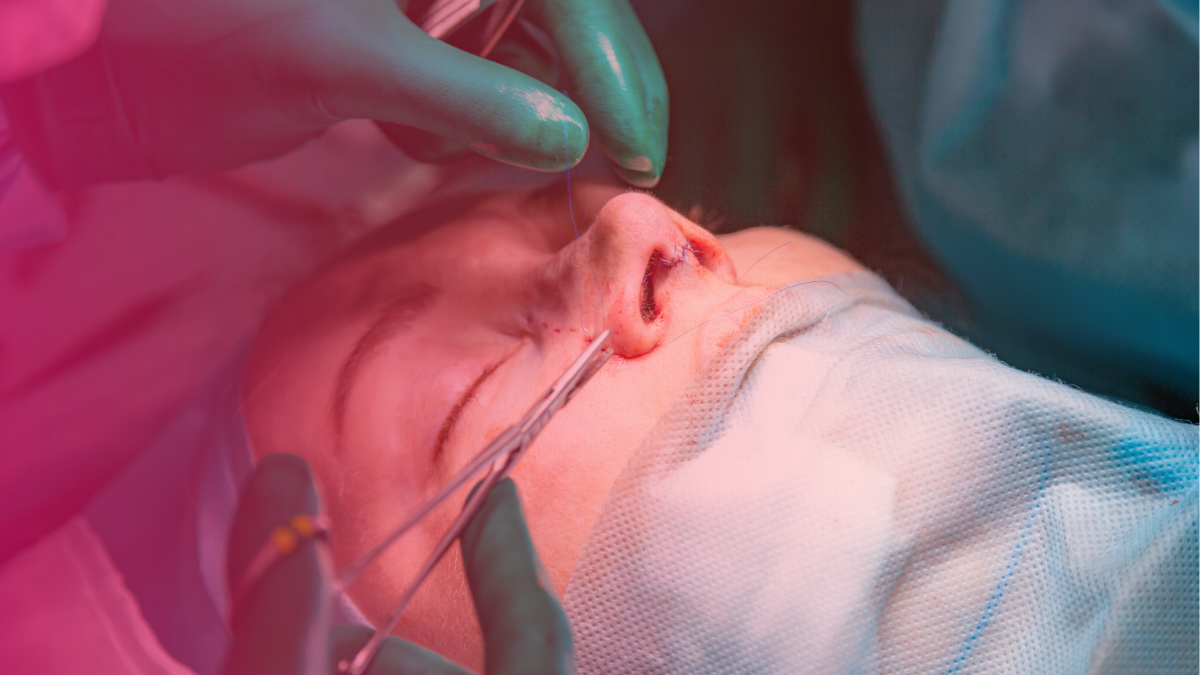 10 Questions to Ask Before Booking Rhinoplasty