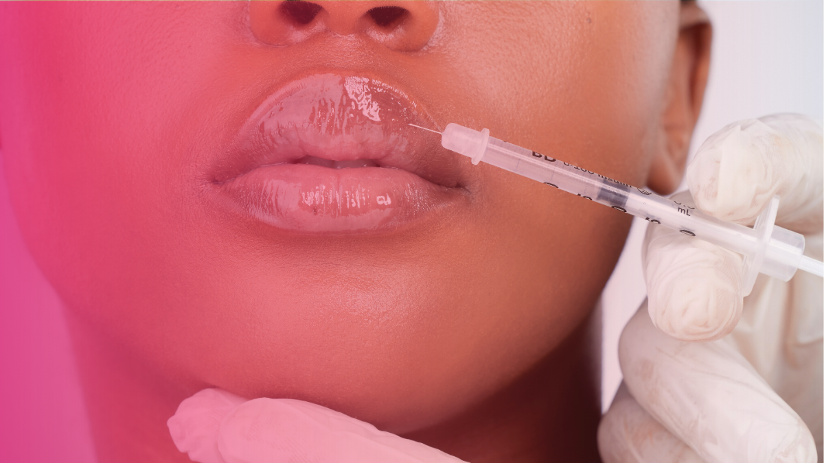 How much do lip fillers usually cost?