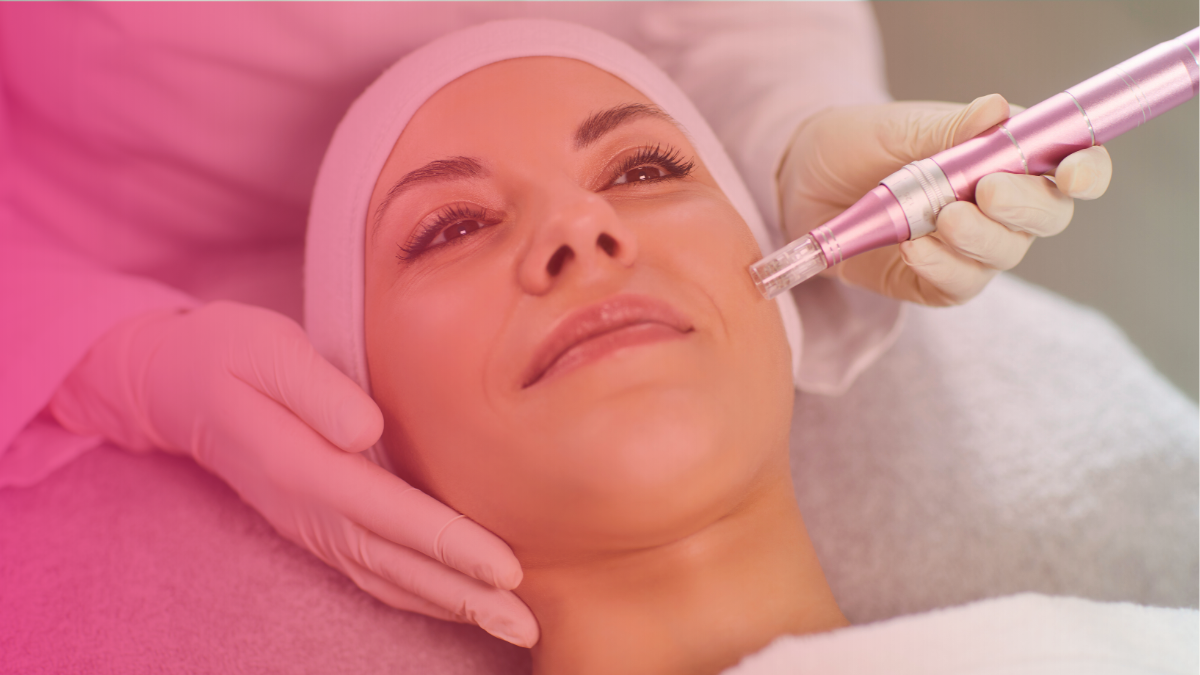 Microneedling vs Laser Resurfacing: Which Is Better for Scars?