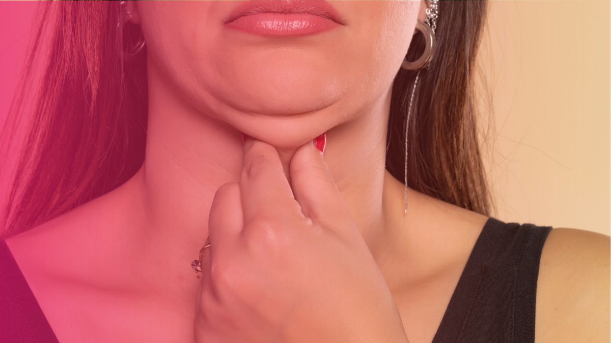 10 Things Nobody Tells You About Kybella